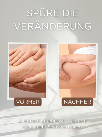 ANTI Cellulite 3D-Leggings